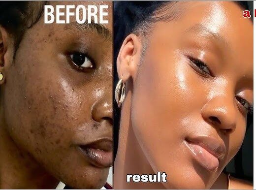 mehn!! see glow naaa